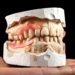 A denture on a gypsum base in the hand of a dentist.