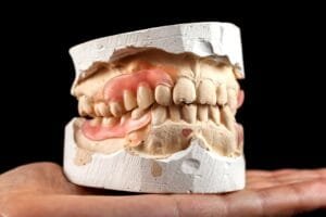 A denture on a gypsum base in the hand of a dentist.