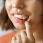 Gingivitis Concept. Young Woman Pulling Her Lip And Demonstrating Irritated Gums